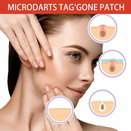 Vista 3 de Pro Microdarts - Parche natural para el cuidado de la piel y la cara, 144 unidades (1 unidad) parches hidrocoloides para acné, parches