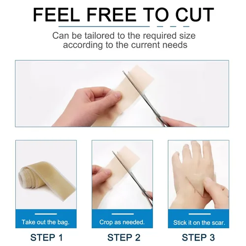 Vista 6 de Hojas de silicona para cicatrices (1.6 x 60 pulgadas), cinta de silicona reutilizable para cicatrices, tiras de silicona de grado médico, fácil