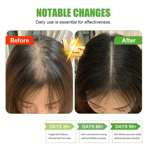 Vista 3 de WAVECRAFTER Aceite de batana 100% crudo, aceite milagroso puro y sin refinar con manteca de karité, vitamina E y aceite de semillas de ricino, sin