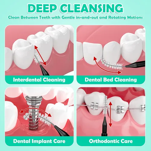 Vista 5 de MAPVOLUT Juego de cepillos interdentales de 320 piezas, púas de hilo dental suaves y flexibles para aparatos ortopédicos, cuidado de ortodoncia
