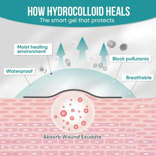 Vista 7 de Rollo hidrocoloide para el cuidado de heridas, vendajes de parche hidrocoloide con autoadhesivo, vendajes para úlceras por presión, altamente