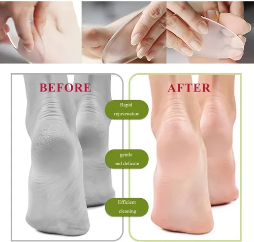 Vista 4 de TORMEN 2 piezas de lima de pie de vidrio Nano removedor de callos para pies herramienta que contiene partículas micro abrasivas adecuadas