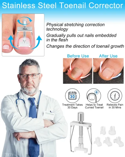 Vista 3 de Kit de eliminación de uñas encarnadas, tratamiento de uñas encarnadas, herramientas correctoras de uñas encarnadas vienen con soportes para uñas
