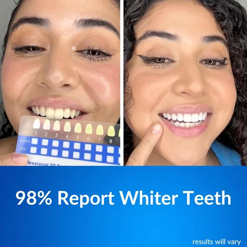 Vista 6 de Polar MD Kit de blanqueamiento de dientes, bolígrafos de gel blanqueadores de dientes profesionales, 1 año de suministro, comparado con tiras
